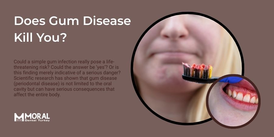 Does Gum Disease Kill You? Dangers & How to Prevent
