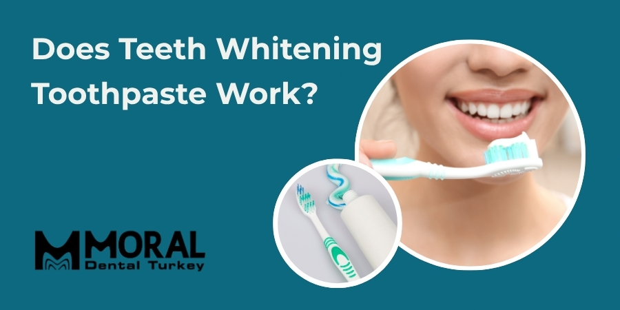 Does Teeth Whitening Toothpaste Work?