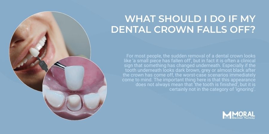 My Crown Fell Off and My Tooth is Black: What Should I Do?