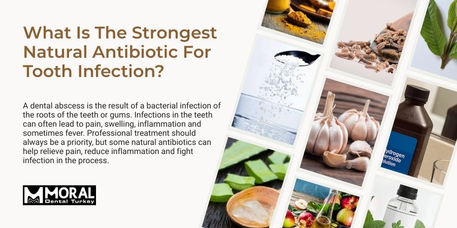 What Is the Strongest Natural Antibiotic for a Tooth Abscess?